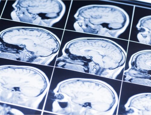 Failure to diagnose brain haemorrhage case settles for £450k